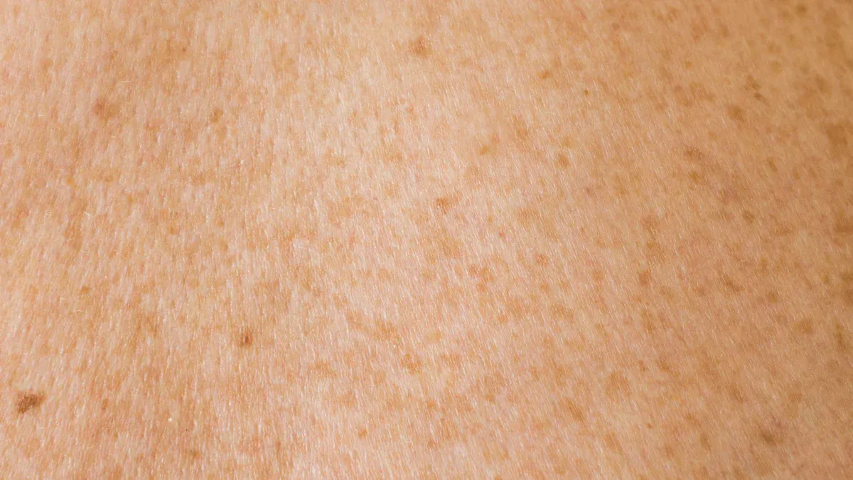 Identify Brown Patch